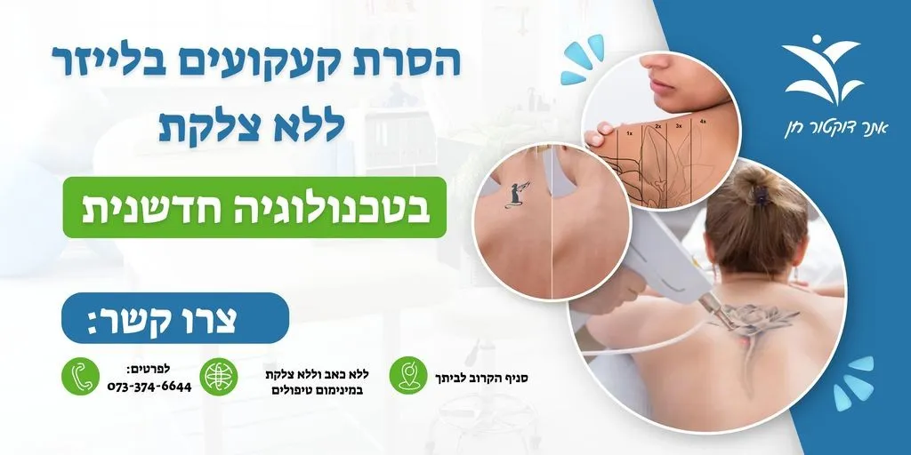 הסרת קעקועים ללא צלקת