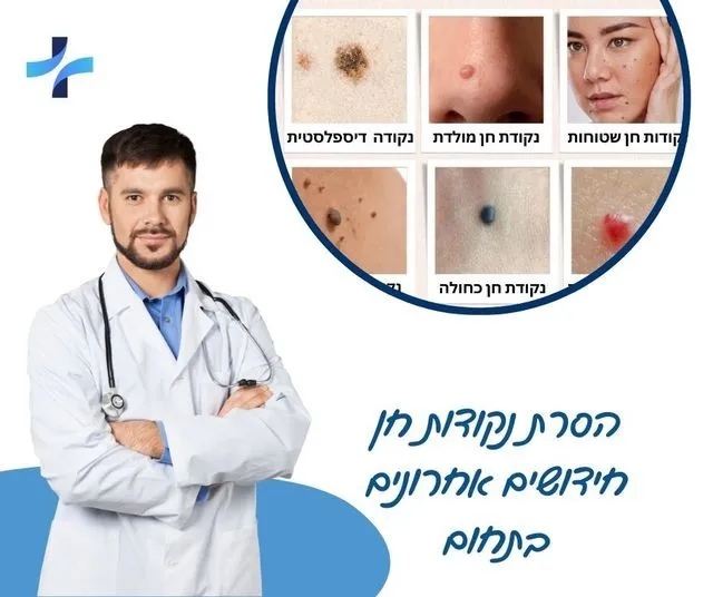 הסרת נקודות חן - חידושים לשנת 2026